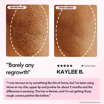 Mave IPL Hair Removal Handset - Smuuv Body